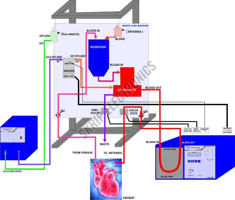 Hemodialysis Machine