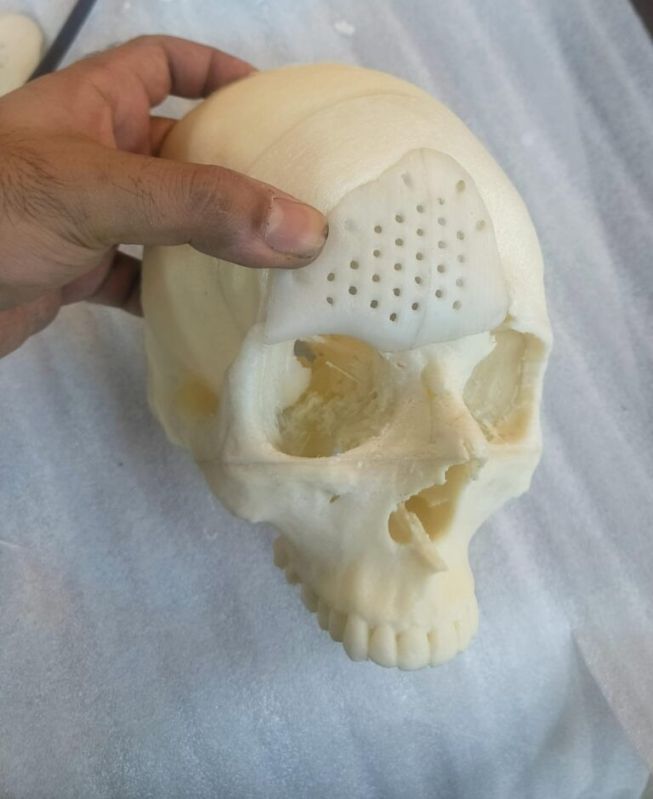 Medical 3d Prototype Printing Services