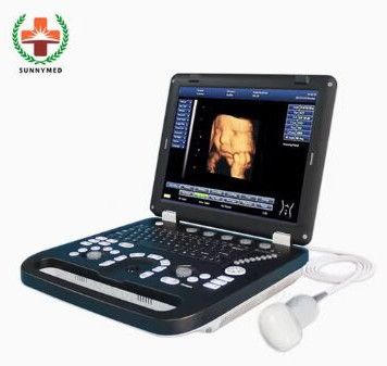SY-A039 Portable 3D & 4D Laptop Ultrasound Machine
