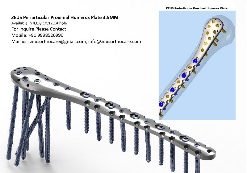 ZEUS Periarticular Proxima Humerus Plate