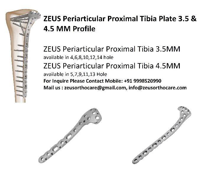 ZEUS Periarticular Proximal Tibia Plate