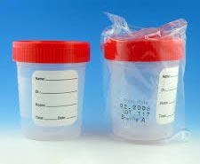 Sterile Sample Containers