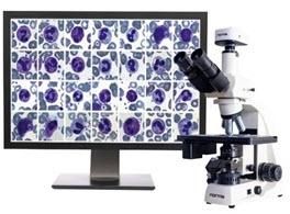 Automated blood cell image analysis system