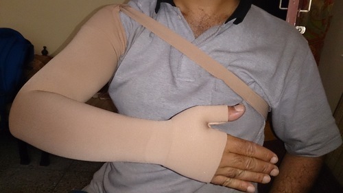 Lymphedema Arm Sleeves at Best Price in Delhi