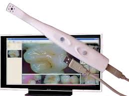 Dental Intraoral Camera