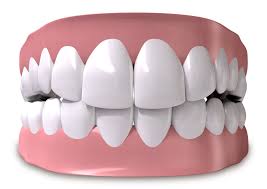 Acrylic Teeth Set