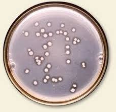 Potash Mobilizing Bacteria