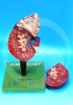 Human Kidney With Adrenal Gland