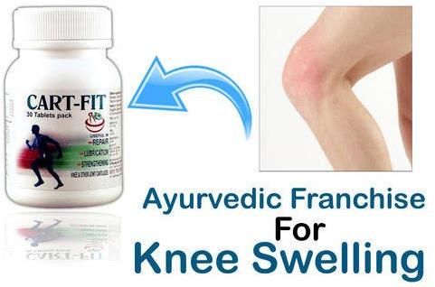 Ayurvedic Franchise For Knee Swelling