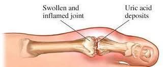 Big Toe Pain Relief Treatment