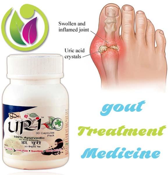 Gout Treatment Medicine