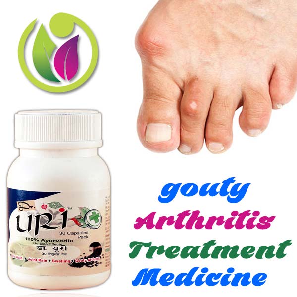 Gouty Arthritis Treatment Medicine