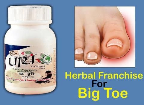 Herbal Franchise For Big Toe