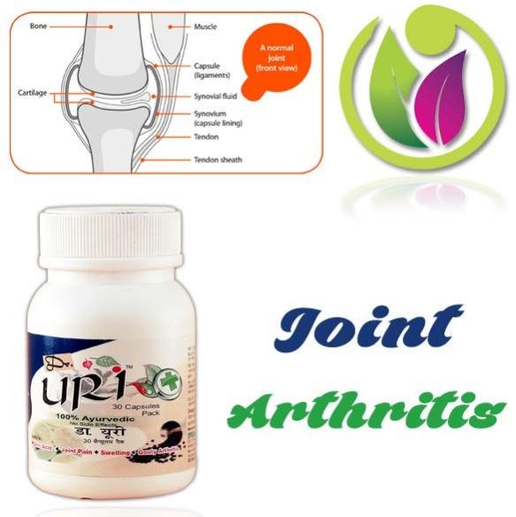 Joint Arthritis