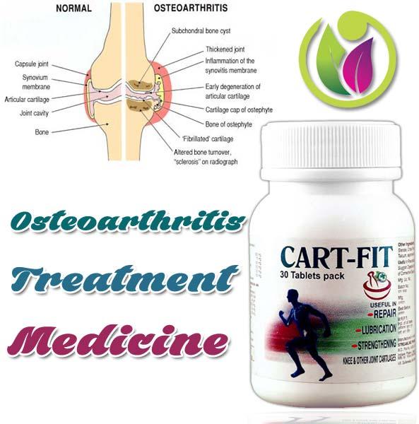 Osteoarthritis Treatment Medicine