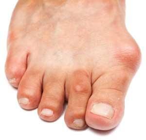 Rheumatic Joint Pain Medicine