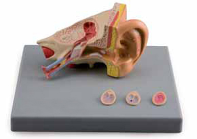 Ear Diseases Model