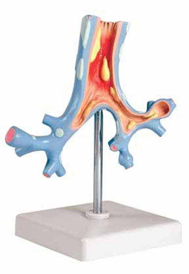 Pathological Model