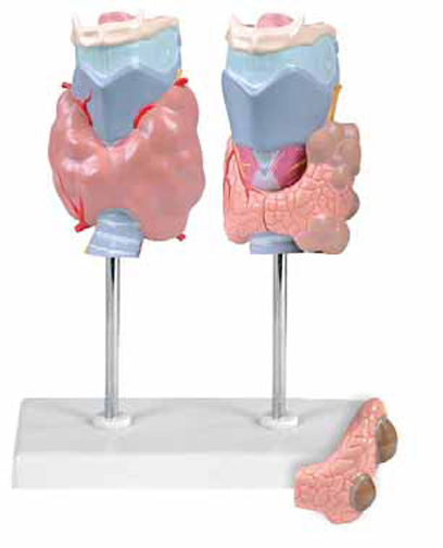 Thyroid Diseases model