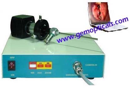 Endoscopic Camera Coupler
