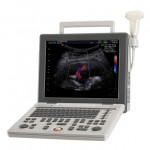 Medison Sonoace R3 Ultrasound