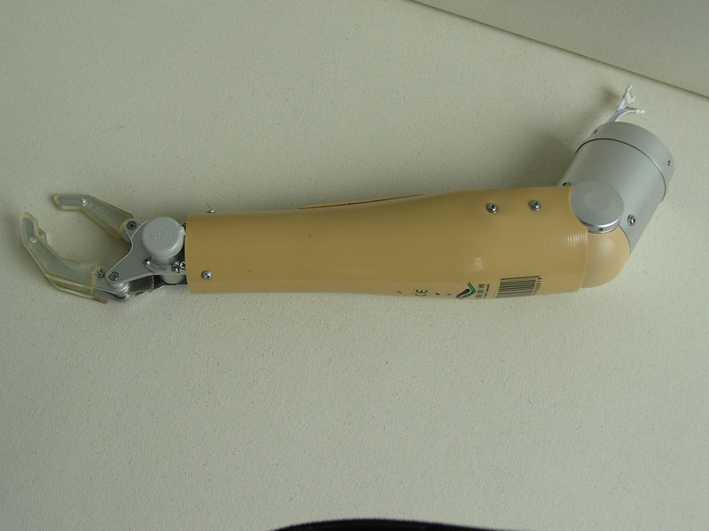 Buy Myoelectric Arm from Dan Yang Jingbo Prosthetics & Orthotics