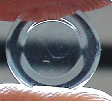 Orthokeratology Contact Lenses