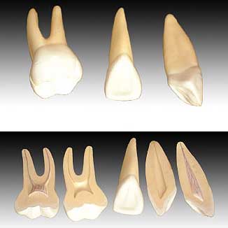 KK - 043 : Expansion Model of Human Teeth