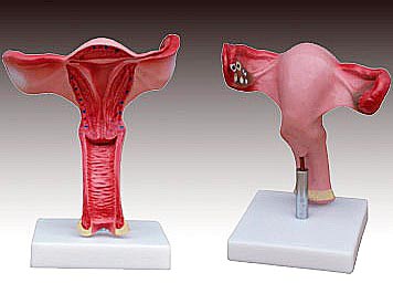 KK -086 Magnified uterus model