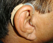 Behind the Ear