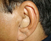 Inside the Ear