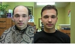 Hair Pasting Services