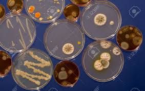 Petri Dish Culture