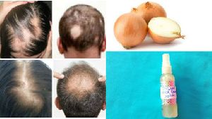 Hair Regrowth Treatment Non Invasive Therapy