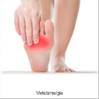 Metatarsalgia or Ball of Foot Pain Treatment in Kolkata