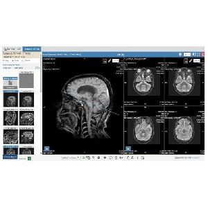 Radiology PACS Software