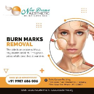 scars burn mark removal clinic