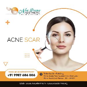 acne treatment aesthetic clinic