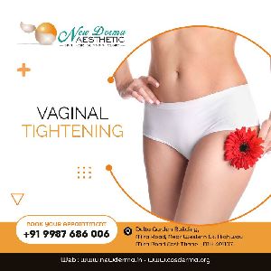 vaginal tightening treatment