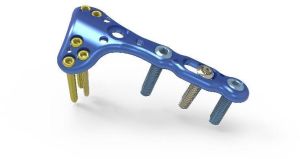 Radiators & Radiator Accessories