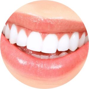 Teeth Whitening Treatment Services