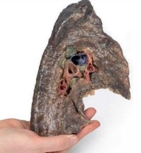 Left Lung Hilum 3D Anatomical Model