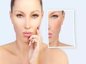 Anti Pigmentation Face Wash