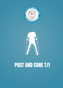 Post and core Treatment