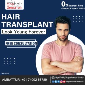 Best FUE Hair Transplant in Velachery - Best Results 100% Gu