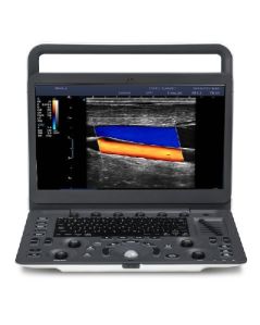 SonoScape E2 Color Doppler Ultrasound