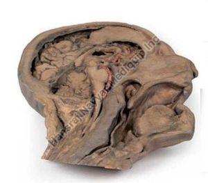 Head and Neck Parasagittal Section 3D Anatomical Model