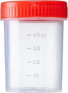 Sterile Urine Container