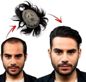 Mens Hair Patch Service