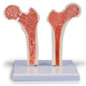 Femur Bone Joint Model